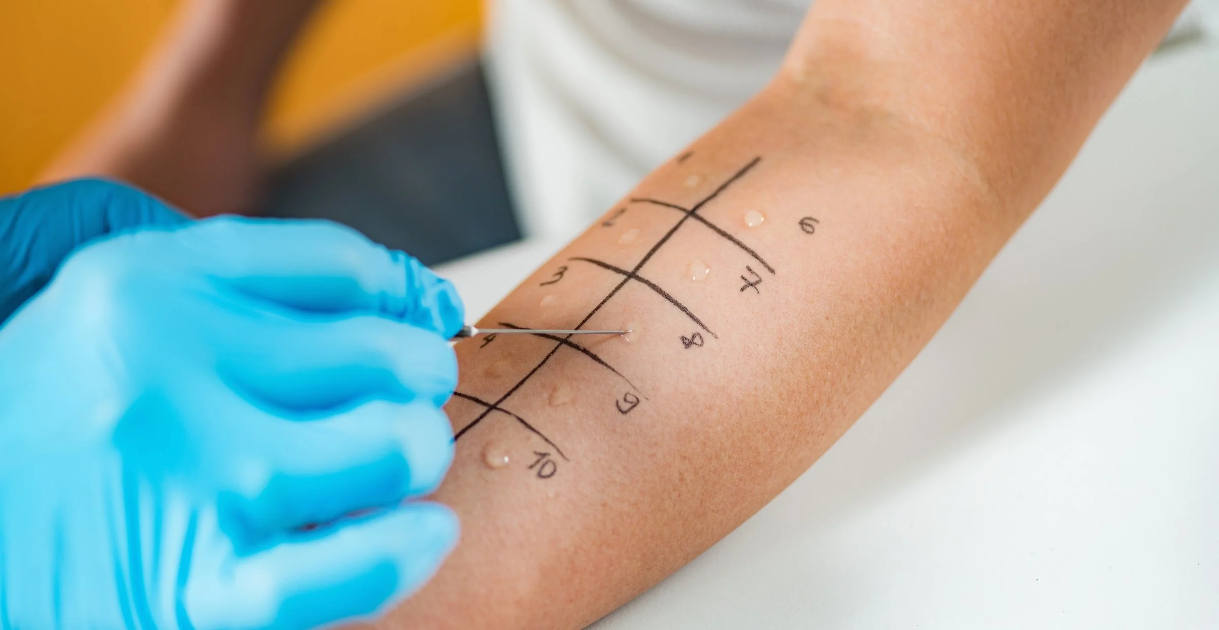 Allergy and Immunology Billing Services